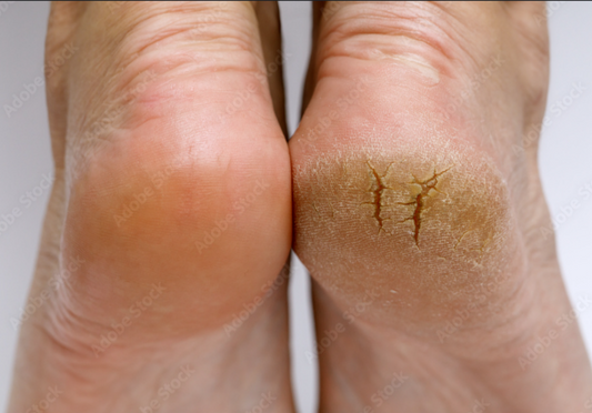 “Goat Milk Hand and Foot Butter, a rich nourishing cream that deeply moisturizes dry skin with natural goat milk.”